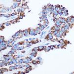 PDHA1 Antibody in Immunohistochemistry (Paraffin) (IHC (P))