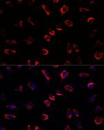 IL-11 Antibody in Immunocytochemistry (ICC/IF)