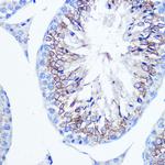 Fascin Antibody in Immunohistochemistry (Paraffin) (IHC (P))