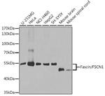 Fascin Antibody in Western Blot (WB)