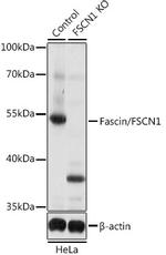 Fascin Antibody in Western Blot (WB)