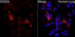 CD204 Antibody in Immunocytochemistry (ICC/IF)