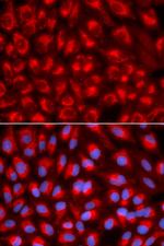 TFAM Antibody in Immunocytochemistry (ICC/IF)