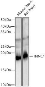 Cardiac Troponin C Antibody in Western Blot (WB)