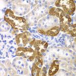 CD151 Antibody in Immunohistochemistry (Paraffin) (IHC (P))