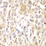 CD151 Antibody in Immunohistochemistry (Paraffin) (IHC (P))