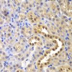 GLO1 Antibody in Immunohistochemistry (Paraffin) (IHC (P))