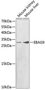 EBAG9 Antibody in Western Blot (WB)