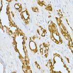 Prostate Specific Acid Phosphatase Antibody in Immunohistochemistry (Paraffin) (IHC (P))