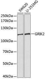 GluR6 Antibody in Western Blot (WB)