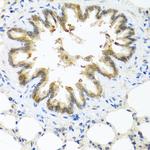 S100A7 Antibody in Immunohistochemistry (Paraffin) (IHC (P))