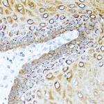 S100A7 Antibody in Immunohistochemistry (Paraffin) (IHC (P))