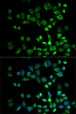 PSMD10 Antibody in Immunocytochemistry (ICC/IF)