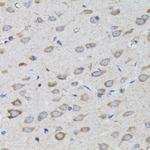 PSMD10 Antibody in Immunohistochemistry (Paraffin) (IHC (P))