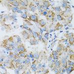 PSMD10 Antibody in Immunohistochemistry (Paraffin) (IHC (P))