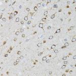 UBE2D1 Antibody in Immunohistochemistry (Paraffin) (IHC (P))