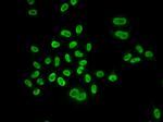 MCM6 Antibody in Immunocytochemistry (ICC/IF)