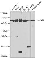 MCM6 Antibody in Western Blot (WB)