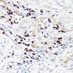 MMP8 Antibody in Immunohistochemistry (Paraffin) (IHC (P))