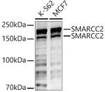 SMARCC2 Antibody in Western Blot (WB)