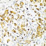 Tapasin Antibody in Immunohistochemistry (Paraffin) (IHC (P))