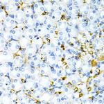 Tapasin Antibody in Immunohistochemistry (Paraffin) (IHC (P))