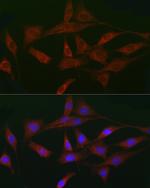 ACVR2A Antibody in Immunocytochemistry (ICC/IF)