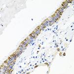 ACVR2A Antibody in Immunohistochemistry (Paraffin) (IHC (P))