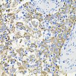 ACVR2A Antibody in Immunohistochemistry (Paraffin) (IHC (P))