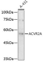 ACVR2A Antibody in Western Blot (WB)