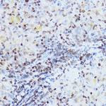 OGT Antibody in Immunohistochemistry (Paraffin) (IHC (P))