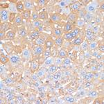 Serum Amyloid P Antibody in Immunohistochemistry (Paraffin) (IHC (P))