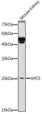 Serum Amyloid P Antibody in Western Blot (WB)