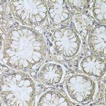 PRL3 Antibody in Immunohistochemistry (Paraffin) (IHC (P))