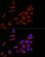 CDA Antibody in Immunocytochemistry (ICC/IF)