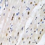 KPNA4 Antibody in Immunohistochemistry (Paraffin) (IHC (P))