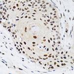 KPNA4 Antibody in Immunohistochemistry (Paraffin) (IHC (P))