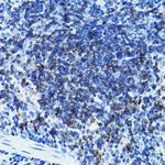 CD79b Antibody in Immunohistochemistry (Paraffin) (IHC (P))