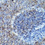 CD79b Antibody in Immunohistochemistry (Paraffin) (IHC (P))