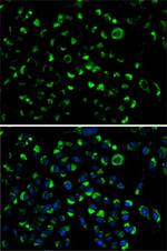 Adenylate Kinase 4 Antibody in Immunocytochemistry (ICC/IF)