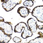 FGFR2 Antibody in Immunohistochemistry (Paraffin) (IHC (P))