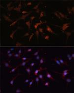 GSK3B Antibody in Immunocytochemistry (ICC/IF)