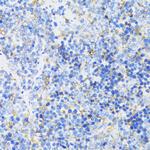 GSK3B Antibody in Immunohistochemistry (Paraffin) (IHC (P))