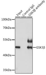 GSK3B Antibody in Immunoprecipitation (IP)