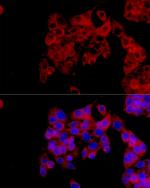 IL1RA Antibody in Immunocytochemistry (ICC/IF)