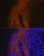 IL1RA Antibody in Immunohistochemistry (Paraffin) (IHC (P))