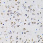 IL-13 Antibody in Immunohistochemistry (Paraffin) (IHC (P))