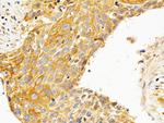 PKC epsilon Antibody in Immunohistochemistry (Paraffin) (IHC (P))