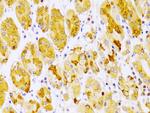 PKC epsilon Antibody in Immunohistochemistry (Paraffin) (IHC (P))