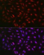 LKB1 Antibody in Immunocytochemistry (ICC/IF)